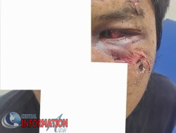 Kasus Pengeroyokan di Labuhan Batu: Keadilan Tertunda?   Tersangka  Belum Ditahan